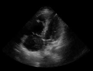 Cardiovascular Sonographer